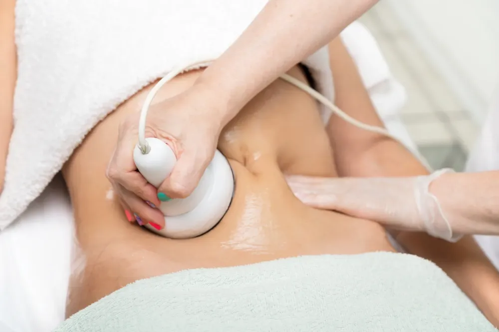 cryosculpt